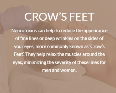 crowfeet