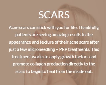 scars 400